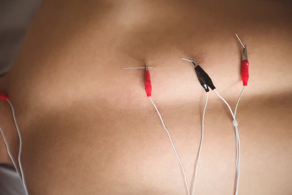 Electro Needling Therapy