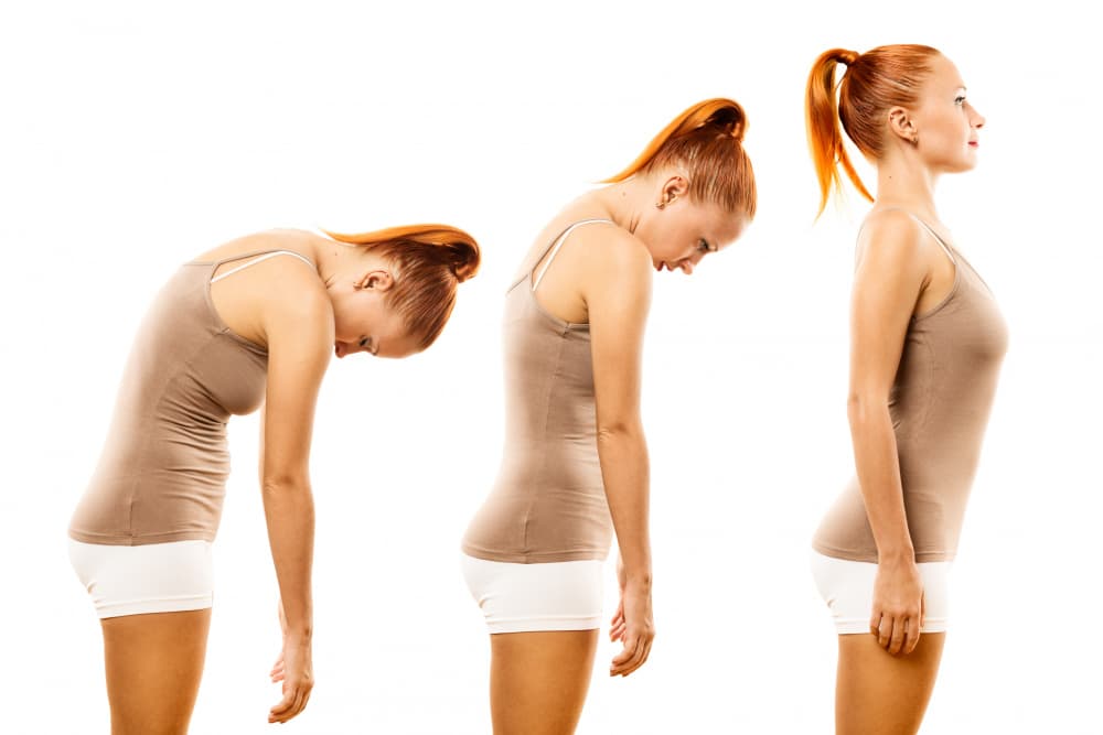 Posture Correction